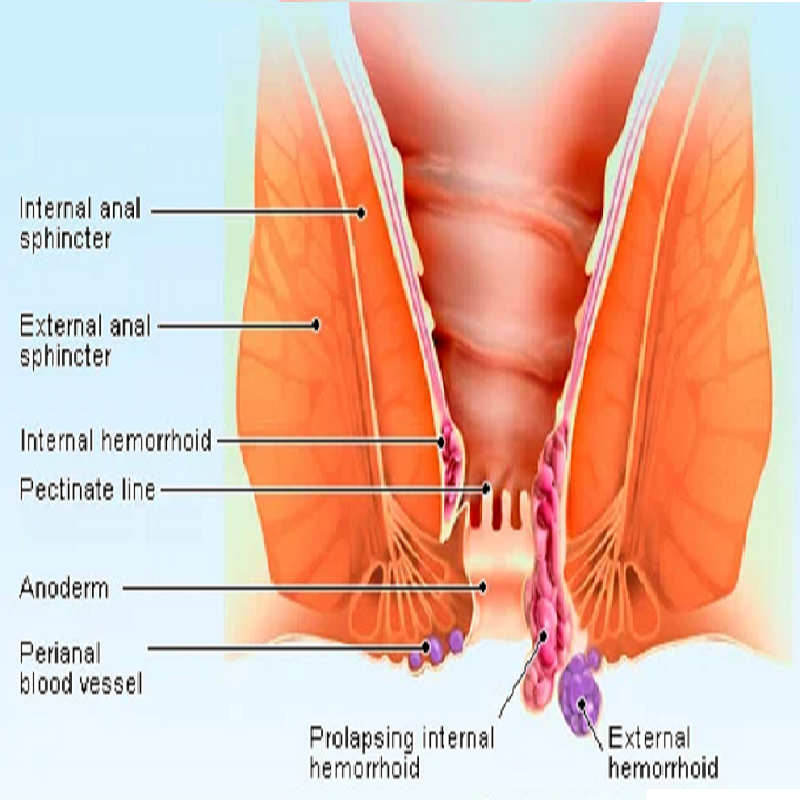 dentist-doctor-arzt-english-british-speaking-calpe-deutschprachiger-altea-zahnarzt-benissa-costa-blanca-albir-notfall-travel-covid-pcr-dentist-19-vithas-alicante-hormone-hemorrhoids.png