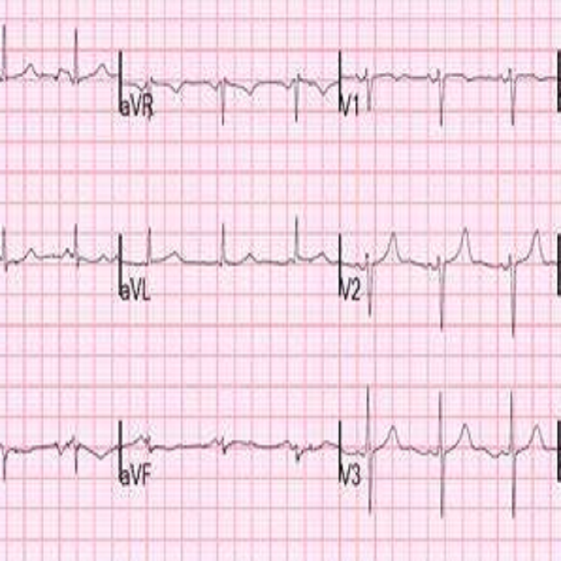 octor-calpe-english-british-speaking-altea-albir-benissa-jalon-xalo-costa-blanca-villajoyosa-disbiosis