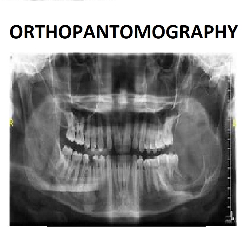 doctor-calpe-english-british-speaking-altea-albir-benissa-costa-blanca-villajoyosa-dentist-covid-dentist-dentistry-home-avion-car-19-alicante-vithas-imed-menopause-hormone-orthopantomography.jpg