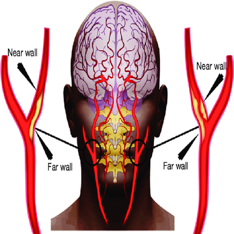 dentist-doctor-arzt-english-british-speaking-calpe-deutchsprachiger-altea-zahnarzt-benissa-blanca-albir-notfall-moraira-covid-19-test-pcr-zahn-dentiste-hernia-botox-wrinkle-carotid.png