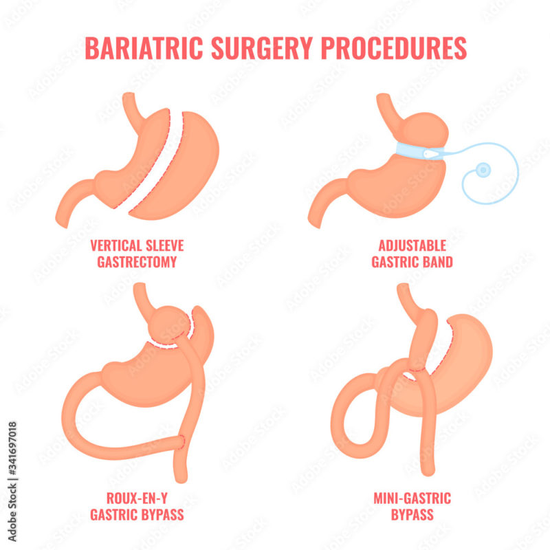 british-speaking-calpe-deutchsprachiger-altea-zahnarzt-benissa-blanca-albir-notfall-moraira-covid-19-test-pcr-zahn-medicocalpe-doctorcalpe-dentistacalpe-englishdentistcalpe-englishdoctorcalpe-bypass-clinicabritannia