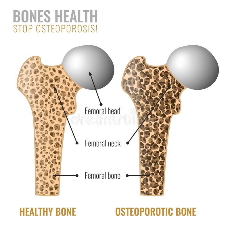 british-speaking-calpe-deutchsprachiger-altea-zahnarzt-benissa-blanca-albir-notfall-moraira-covid-19-test-pcr-zahn-medicocalpe-doctorcalpe-dentistacalpe-englishdentistcalpe-englishdoctorcalpe-osteoporosis-clinicabritannia