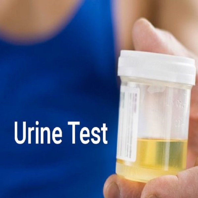 Microalbumin Urine Test. 02/05/2022. – Clinica Britannia